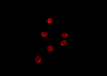 NRBF2 Antibody - Staining HepG2 cells by IF/ICC. The samples were fixed with PFA and permeabilized in 0.1% Triton X-100, then blocked in 10% serum for 45 min at 25°C. The primary antibody was diluted at 1:200 and incubated with the sample for 1 hour at 37°C. An Alexa Fluor 594 conjugated goat anti-rabbit IgG (H+L) Ab, diluted at 1/600, was used as the secondary antibody.