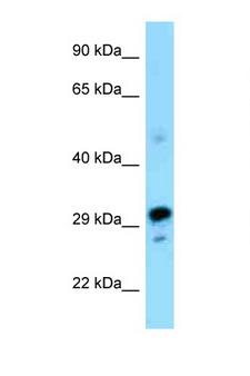 NRBF2 Antibody - NRBF2 antibody Western blot of Mouse Pancreas lysate. Antibody concentration 1 ug/ml.  This image was taken for the unconjugated form of this product. Other forms have not been tested.