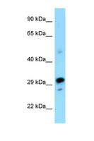 NRBF2 Antibody - NRBF2 antibody Western blot of Mouse Pancreas lysate. Antibody concentration 1 ug/ml.  This image was taken for the unconjugated form of this product. Other forms have not been tested.