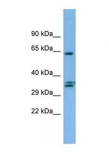 NRBP1 / NRBP Antibody - Western blot of Human 721_B. NRBP1 antibody dilution 1.0 ug/ml.  This image was taken for the unconjugated form of this product. Other forms have not been tested.