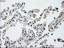 NRBP1 / NRBP Antibody - IHC of paraffin-embedded lung tissue using anti-NRBP1 mouse monoclonal antibody. (Dilution 1:50).