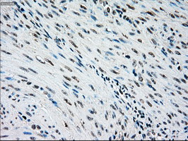 NRBP1 / NRBP Antibody - IHC of paraffin-embedded endometrium tissue using anti-NRBP1 mouse monoclonal antibody. (Dilution 1:50).