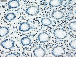 NRBP1 / NRBP Antibody - Immunohistochemical staining of paraffin-embedded colon tissue using anti-NRBP1 mouse monoclonal antibody. (Dilution 1:50).