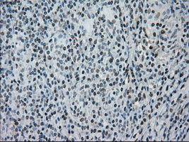 NRBP1 / NRBP Antibody - Immunohistochemical staining of paraffin-embedded lymphoma tissue using anti-NRBP1 mouse monoclonal antibody. (Dilution 1:50).