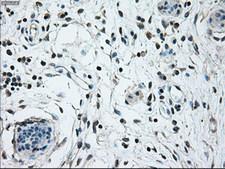 NRBP1 / NRBP Antibody - IHC of paraffin-embedded breast tissue using anti-NRBP1 mouse monoclonal antibody. (Dilution 1:50).