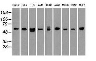 NRBP1 / NRBP Antibody - Western blot of extracts (35 ug) from 9 different cell lines by using anti-anti-NRBP1monoclonal antibody.