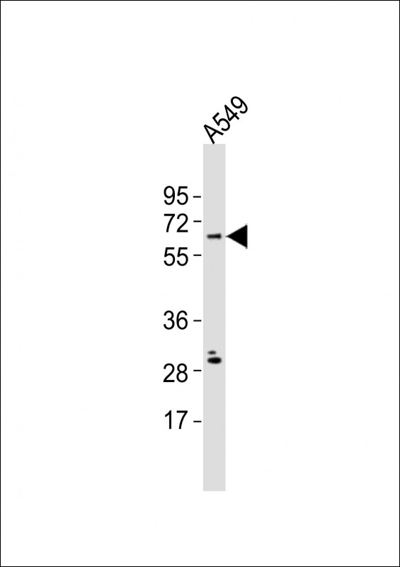 NRBP2 Antibody - Anti-NRBP2 Antibody at 1:500 dilution + A549 whole cell lysates Lysates/proteins at 20 ug per lane. Secondary Goat Anti-Rabbit IgG, (H+L), Peroxidase conjugated at 1/10000 dilution Predicted band size : 58 kDa Blocking/Dilution buffer: 5% NFDM/TBST.