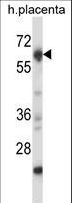 NRBP2 Antibody - Mouse Nrbp2 Antibody western blot of human placenta tissue lysates (35 ug/lane). The Nrbp2 antibody detected the Nrbp2 protein (arrow).