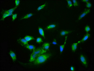 NRBP2 Antibody - Immunofluorescence staining of Hela cells with NRBP2 Antibody at 1:133, counter-stained with DAPI. The cells were fixed in 4% formaldehyde, permeabilized using 0.2% Triton X-100 and blocked in 10% normal Goat Serum. The cells were then incubated with the antibody overnight at 4°C. The secondary antibody was Alexa Fluor 488-congugated AffiniPure Goat Anti-Rabbit IgG(H+L).