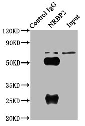 NRBP2 Antibody - Immunoprecipitating NRBP2 in A549 whole cell lysate Lane 1: Rabbit control IgG (1µg) instead of NRBP2 Antibody in A549 whole cell lysate.For western blotting, a HRP-conjugated Protein G antibody was used as the secondary antibody (1/2000) Lane 2: NRBP2 Antibody (6µg) + A549 whole cell lysate (500µg) Lane 3: A549 whole cell lysate (10µg)