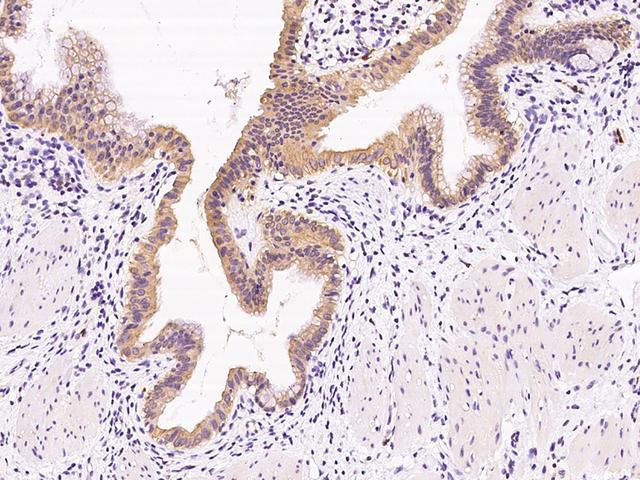 NRBP2 Antibody - Immunochemical staining of human NRBP2 in human gallbladder with rabbit polyclonal antibody at 1:300 dilution, formalin-fixed paraffin embedded sections.