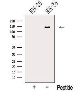 NRCAM Antibody - Western blot analysis of extracts of HEK293 cells using NRCAM antibody. The lane on the left was treated with blocking peptide.