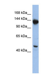 NRD1 / Nardilysin Antibody - NRD1 antibody Western blot of HepG2 cell lysate. This image was taken for the unconjugated form of this product. Other forms have not been tested.