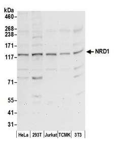 NRD1 / Nardilysin Antibody - Detection of human and mouse NRD1 by western blot. Samples: Whole cell lysate (50 µg) from HeLa, HEK293T, Jurkat, mouse TCMK-1, and mouse NIH 3T3 cells prepared using NETN lysis buffer. Antibody: Affinity purified rabbit anti-NRD1 antibody used for WB at 0.1 µg/ml. Detection: Chemiluminescence with an exposure time of 30 seconds.