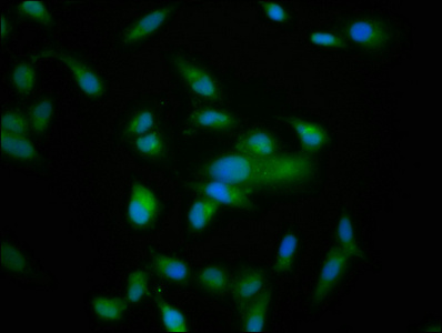 NRD1 / Nardilysin Antibody - Immunofluorescence staining of Hela cells at a dilution of 1:166, counter-stained with DAPI. The cells were fixed in 4% formaldehyde, permeabilized using 0.2% Triton X-100 and blocked in 10% normal Goat Serum. The cells were then incubated with the antibody overnight at 4 °C.The secondary antibody was Alexa Fluor 488-congugated AffiniPure Goat Anti-Rabbit IgG (H+L) .