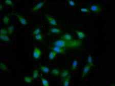 NRD1 / Nardilysin Antibody - Immunofluorescence staining of Hela cells at a dilution of 1:166, counter-stained with DAPI. The cells were fixed in 4% formaldehyde, permeabilized using 0.2% Triton X-100 and blocked in 10% normal Goat Serum. The cells were then incubated with the antibody overnight at 4 °C.The secondary antibody was Alexa Fluor 488-congugated AffiniPure Goat Anti-Rabbit IgG (H+L) .