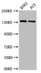 NRD1 / Nardilysin Antibody - Positive Western Blot detected in K562 whole cell lysate, PC3 whole cell lysate. All lanes: NRDC antibody at 3.73 µg/ml Secondary Goat polyclonal to rabbit IgG at 1/50000 dilution. Predicted band size: 132, 140 KDa. Observed band size: 132 KDa