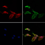 NRDE2 / C14orf102 Antibody - Staining HeLa cells by IF/ICC. The samples were fixed with PFA and permeabilized in 0.1% Triton X-100, then blocked in 10% serum for 45 min at 25°C. Samples were then incubated with primary Ab(1:200) and mouse anti-beta tubulin Ab(1:200) for 1 hour at 37°C. An AlexaFluor594 conjugated goat anti-rabbit IgG(H+L) Ab(1:200 Red) and an AlexaFluor488 conjugated goat anti-mouse IgG(H+L) Ab(1:600 Green) were used as the secondary antibod