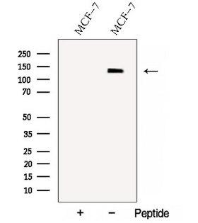 NRDE2 / C14orf102 Antibody