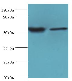 NRF1 / NRF-1 Antibody - Western blot. All lanes: Nuclear respiratory factor 1 antibody at 3 ug/ml. Lane 1: mouse skeletal muscle tissue. Lane 2: MCF-7 whole cell lysate. Secondary antibody: Goat polyclonal to rabbit at 1:10000 dilution. Predicted band size: 54 kDa. Observed band size: 54 kDa Immunohistochemistry.