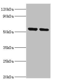 NRF1 / NRF-1 Antibody - Western blot All lanes: Nuclear respiratory factor 1 antibody at 3µg/ml Lane 1: Mouse skeletal muscle tissue Lane 2: MCF-7 whole cell lysate Secondary Goat polyclonal to rabbit IgG at 1/10000 dilution Predicted band size: 54, 47, 37, 56 kDa Observed band size: 54 kDa