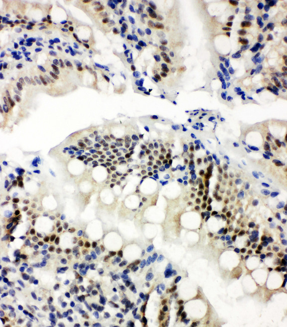 NRF1 / NRF-1 Antibody - NRF1 / NRF-1 antibody. IHC(P): Rat Intestine Tissue.