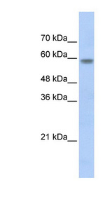 NRF1 / NRF-1 Antibody - NRF1 antibody Western blot of Transfected 293T cell lysate. This image was taken for the unconjugated form of this product. Other forms have not been tested.