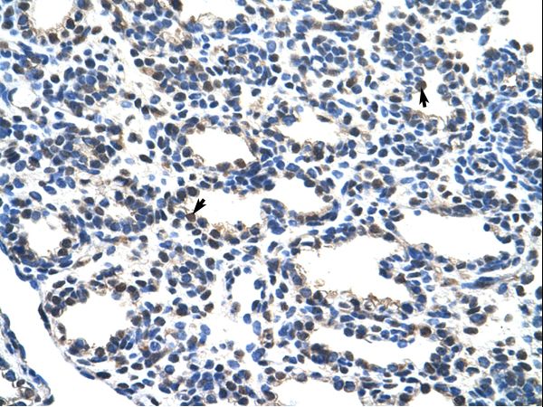 NRF1 / NRF-1 Antibody - NRF1 antibody ARP38543_T100-NP_005002-NRF1(nuclear respiratory factor 1) Antibody was used in IHC to stain formalin-fixed, paraffin-embedded human lung.  This image was taken for the unconjugated form of this product. Other forms have not been tested.