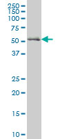NRF1 / NRF-1 Antibody - NRF1 monoclonal antibody (M01), clone 2F9. Western blot of NRF1 expression in human Skeletal muscle.