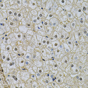 NRF1 / NRF-1 Antibody - Immunohistochemistry of paraffin-embedded human liver injury using NRF1 Antibody at dilution of 1:100 (40x lens).