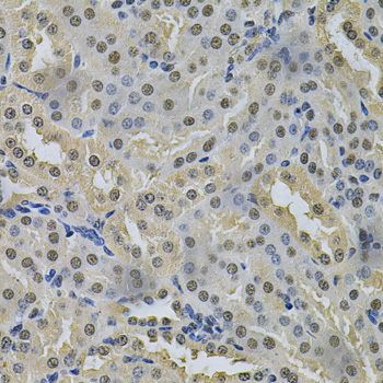 NRF1 / NRF-1 Antibody - Immunohistochemistry of paraffin-embedded mouse kidney using NRF1 Antibody at dilution of 1:100 (40x lens).