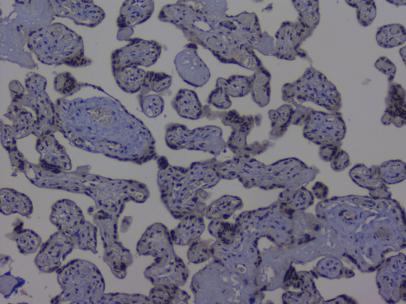 NRF1 / NRF-1 Antibody - IHC analysis of NRF1 using anti-NRF1 antibody. NRF1 was detected in paraffin-embedded section of human placenta tissue. Heat mediated antigen retrieval was performed in citrate buffer (pH6, epitope retrieval solution) for 20 mins. The tissue section was blocked with 10% goat serum. The tissue section was then incubated with 1µg/ml rabbit anti-NRF1 Antibody overnight at 4°C. Biotinylated goat anti-rabbit IgG was used as secondary antibody and incubated for 30 minutes at 37°C. The tissue section was developed using Strepavidin-Biotin-Complex (SABC) with DAB as the chromogen.