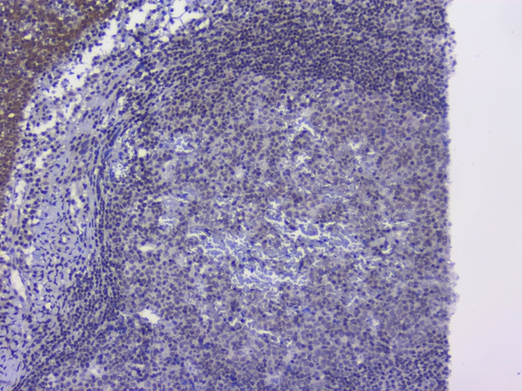 NRF1 / NRF-1 Antibody - IHC analysis of NRF1 using anti-NRF1 antibody. NRF1 was detected in paraffin-embedded section of human tonsil tissue. Heat mediated antigen retrieval was performed in citrate buffer (pH6, epitope retrieval solution) for 20 mins. The tissue section was blocked with 10% goat serum. The tissue section was then incubated with 1µg/ml rabbit anti-NRF1 Antibody overnight at 4°C. Biotinylated goat anti-rabbit IgG was used as secondary antibody and incubated for 30 minutes at 37°C. The tissue section was developed using Strepavidin-Biotin-Complex (SABC) with DAB as the chromogen.