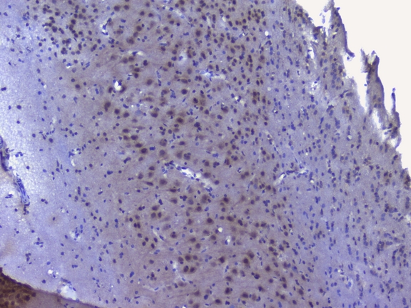NRF1 / NRF-1 Antibody - IHC analysis of NRF1 using anti-NRF1 antibody. NRF1 was detected in paraffin-embedded section of rat brain tissue. Heat mediated antigen retrieval was performed in citrate buffer (pH6, epitope retrieval solution) for 20 mins. The tissue section was blocked with 10% goat serum. The tissue section was then incubated with 1µg/ml rabbit anti-NRF1 Antibody overnight at 4°C. Biotinylated goat anti-rabbit IgG was used as secondary antibody and incubated for 30 minutes at 37°C. The tissue section was developed using Strepavidin-Biotin-Complex (SABC) with DAB as the chromogen.