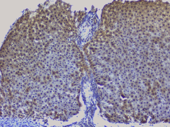 NRF1 / NRF-1 Antibody - IHC analysis of NRF1 using anti-NRF1 antibody. NRF1 was detected in paraffin-embedded section of rat liver tissue. Heat mediated antigen retrieval was performed in citrate buffer (pH6, epitope retrieval solution) for 20 mins. The tissue section was blocked with 10% goat serum. The tissue section was then incubated with 1µg/ml rabbit anti-NRF1 Antibody overnight at 4°C. Biotinylated goat anti-rabbit IgG was used as secondary antibody and incubated for 30 minutes at 37°C. The tissue section was developed using Strepavidin-Biotin-Complex (SABC) with DAB as the chromogen.