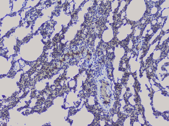 NRF1 / NRF-1 Antibody - IHC analysis of NRF1 using anti-NRF1 antibody. NRF1 was detected in paraffin-embedded section of rat lung tissue. Heat mediated antigen retrieval was performed in citrate buffer (pH6, epitope retrieval solution) for 20 mins. The tissue section was blocked with 10% goat serum. The tissue section was then incubated with 1µg/ml rabbit anti-NRF1 Antibody overnight at 4°C. Biotinylated goat anti-rabbit IgG was used as secondary antibody and incubated for 30 minutes at 37°C. The tissue section was developed using Strepavidin-Biotin-Complex (SABC) with DAB as the chromogen.