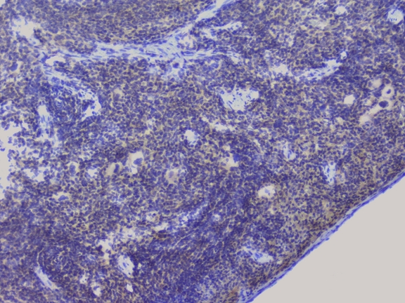 NRF1 / NRF-1 Antibody - IHC analysis of NRF1 using anti-NRF1 antibody. NRF1 was detected in paraffin-embedded section of rat spleen tissue. Heat mediated antigen retrieval was performed in citrate buffer (pH6, epitope retrieval solution) for 20 mins. The tissue section was blocked with 10% goat serum. The tissue section was then incubated with 1µg/ml rabbit anti-NRF1 Antibody overnight at 4°C. Biotinylated goat anti-rabbit IgG was used as secondary antibody and incubated for 30 minutes at 37°C. The tissue section was developed using Strepavidin-Biotin-Complex (SABC) with DAB as the chromogen.