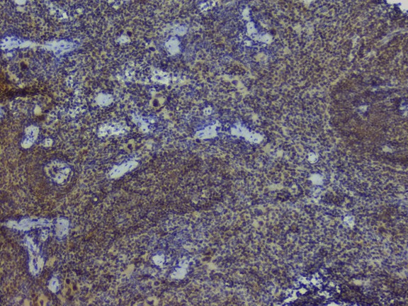 NRF1 / NRF-1 Antibody - IHC analysis of NRF1 using anti-NRF1 antibody. NRF1 was detected in paraffin-embedded section of mouse spleen tissue. Heat mediated antigen retrieval was performed in citrate buffer (pH6, epitope retrieval solution) for 20 mins. The tissue section was blocked with 10% goat serum. The tissue section was then incubated with 1µg/ml rabbit anti-NRF1 Antibody overnight at 4°C. Biotinylated goat anti-rabbit IgG was used as secondary antibody and incubated for 30 minutes at 37°C. The tissue section was developed using Strepavidin-Biotin-Complex (SABC) with DAB as the chromogen.