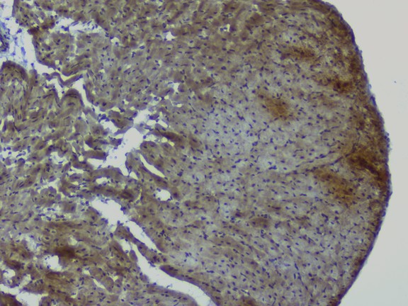 NRF1 / NRF-1 Antibody - IHC analysis of NRF1 using anti-NRF1 antibody. NRF1 was detected in paraffin-embedded section of rat heart tissue. Heat mediated antigen retrieval was performed in citrate buffer (pH6, epitope retrieval solution) for 20 mins. The tissue section was blocked with 10% goat serum. The tissue section was then incubated with 1µg/ml rabbit anti-NRF1 Antibody overnight at 4°C. Biotinylated goat anti-rabbit IgG was used as secondary antibody and incubated for 30 minutes at 37°C. The tissue section was developed using Strepavidin-Biotin-Complex (SABC) with DAB as the chromogen.