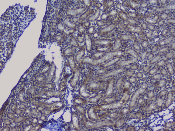 NRF1 / NRF-1 Antibody - IHC analysis of NRF1 using anti-NRF1 antibody. NRF1 was detected in paraffin-embedded section of rat kidney tissue. Heat mediated antigen retrieval was performed in citrate buffer (pH6, epitope retrieval solution) for 20 mins. The tissue section was blocked with 10% goat serum. The tissue section was then incubated with 1µg/ml rabbit anti-NRF1 Antibody overnight at 4°C. Biotinylated goat anti-rabbit IgG was used as secondary antibody and incubated for 30 minutes at 37°C. The tissue section was developed using Strepavidin-Biotin-Complex (SABC) with DAB as the chromogen.