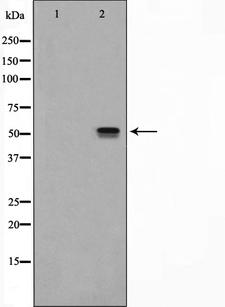 NRF1 / NRF-1 Antibody - Western blot analysis of NRF1 expression in HeLa cells lysate. The lane on the left is treated with the antigen-specific peptide.