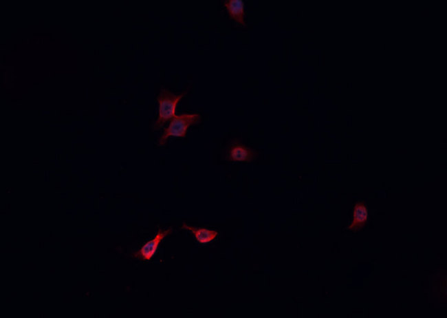 NRF1 / NRF-1 Antibody - Staining NIH-3T3 cells by IF/ICC. The samples were fixed with PFA and permeabilized in 0.1% Triton X-100, then blocked in 10% serum for 45 min at 25°C. The primary antibody was diluted at 1:200 and incubated with the sample for 1 hour at 37°C. An Alexa Fluor 594 conjugated goat anti-rabbit IgG (H+L) Ab, diluted at 1/600, was used as the secondary antibody.
