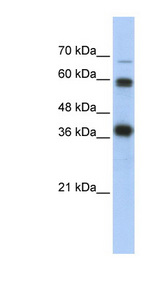 NRF1 / NRF-1 Antibody - NRF1 antibody western blot of Transfected 293T cell lysate.  This image was taken for the unconjugated form of this product. Other forms have not been tested.