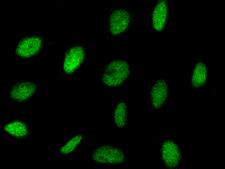 NRF1 / NRF-1 Antibody - Immunofluorescence staining of NRF1 in HeLa cells. Cells were fixed with 4% PFA, permeabilzed with 0.3% Triton X-100 in PBS, blocked with 10% serum, and incubated with rabbit anti-Human NRF1 polyclonal antibody (dilution ratio 1:1000) at 4°C overnight. Then cells were stained with the Alexa Fluor 488-conjugated Goat Anti-rabbit IgG secondary antibody (green). Positive staining was localized to nucleus.