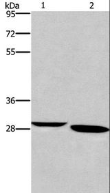 NRG1 / Heregulin / Neuregulin Antibody - Western blot analysis of Mouse brain tissue and A172 cell, using NRG1 Polyclonal Antibody at dilution of 1:650.