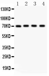 NRG1 / Heregulin / Neuregulin Antibody - NRG1 antibody Western blot. All lanes: Anti NRG1 at 0.5 ug/ml. Lane 1: MCF-7 Whole Cell Lysate at 40 ug. Lane 2: SKOV Whole Cell Lysate at 40 ug. Lane 3: 22RV1 Whole Cell Lysate at 40 ug. Lane 4: COLO320 Whole Cell Lysate at 40 ug. Predicted band size: 70 kD. Observed band size: 70 kD.