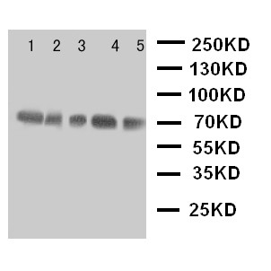 NRG1 / Heregulin / Neuregulin Antibody - WB of NRG1 / Heregulin / Neuregulin antibody. Lane 1: Rat Spleen Tissue Lysate. Lane 2: Rat Kidney Tissue Lysate. Lane 3: Rat Brain Tissue Lysate. Lane 4: HELA Cell Lysate. Lane 5: SMMC Cell Lysate.