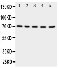NRG1 / Heregulin / Neuregulin Antibody - Anti-NRG1 antibody, Western blotting Lane 1: Rat Spleen Tissue LysateLane 2: Rat Kidney Tissue LysateLane 3: Rat Brain Tissue LysateLane 4: HELA Cell LysateLane 5: SMMC Cell Lysate