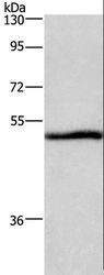 NRG1 / Heregulin / Neuregulin Antibody - Western blot analysis of A549 cell, using NRG1 Polyclonal Antibody at dilution of 1:500.