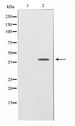 NRG1 / Heregulin / Neuregulin Antibody - Western blot of SK-OV3 cell lysate using NRG1 isoform-10 Antibody